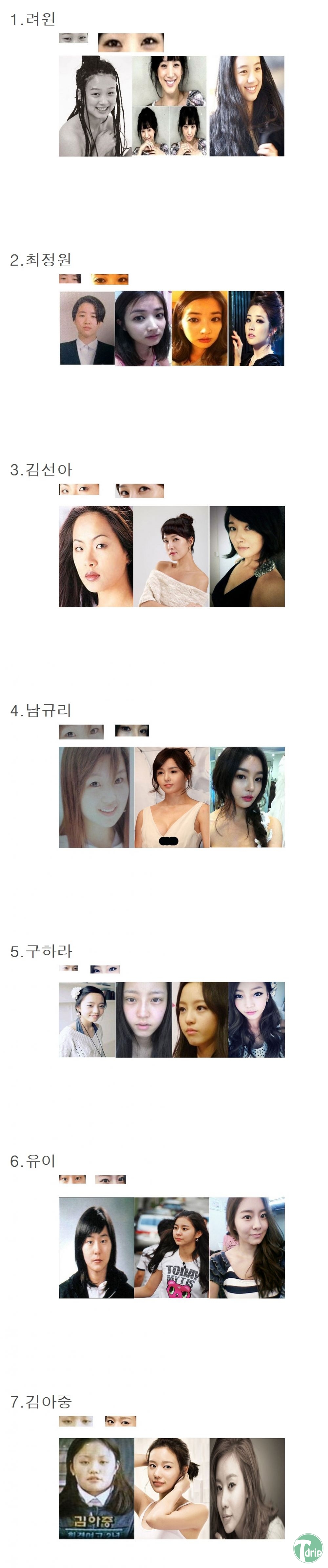 1 (6).jpg : 쌍수 대박난 연예인들.JPG