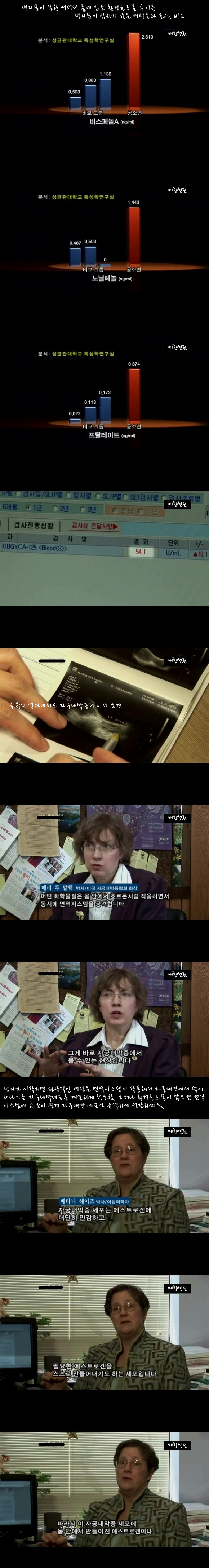 생리통2.jpg