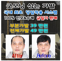 대머리.png