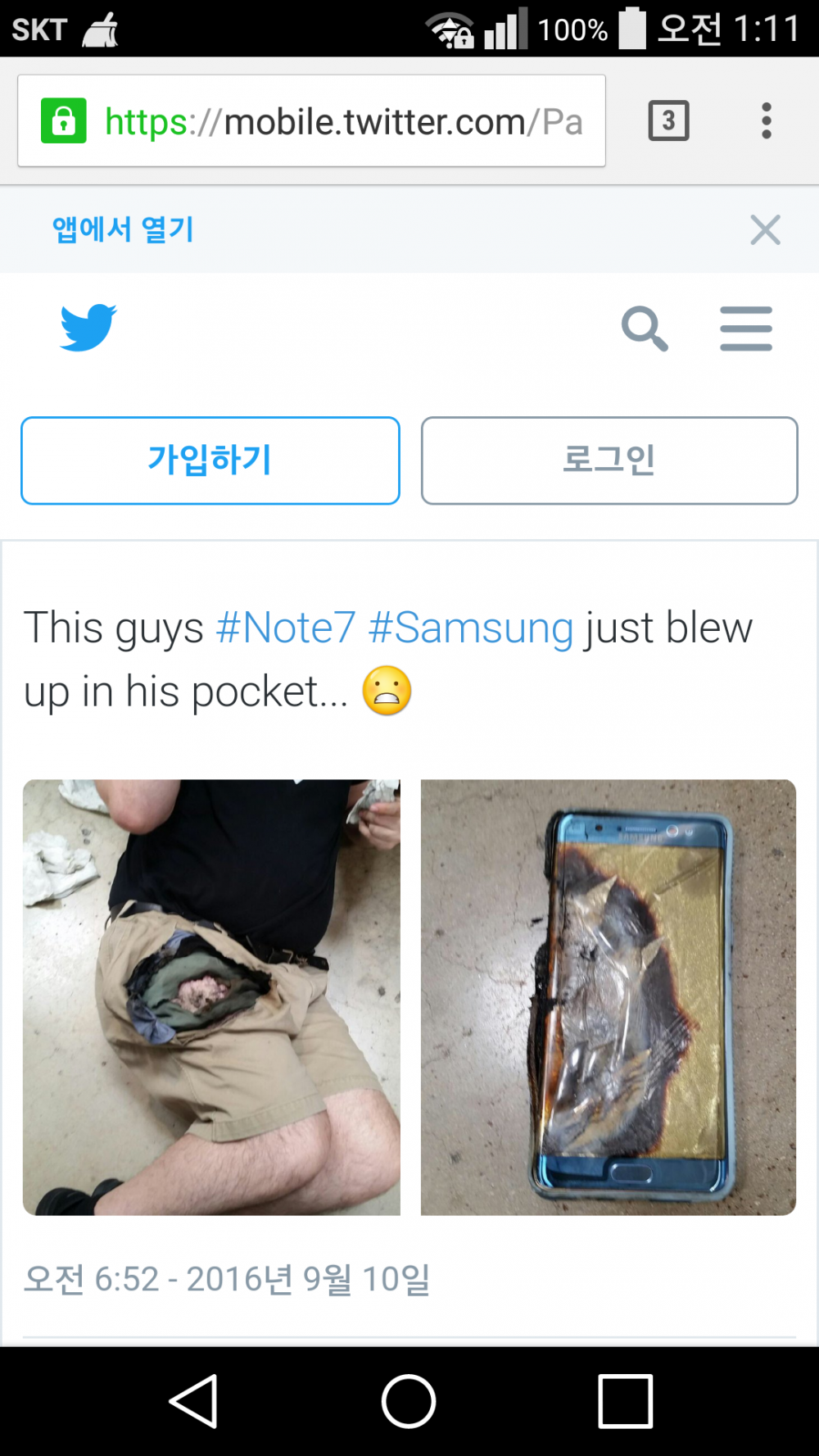 Screenshot_2016-09-11-01-11-24.png : 노트 7, 자연발화로 다리 화상사고 발생