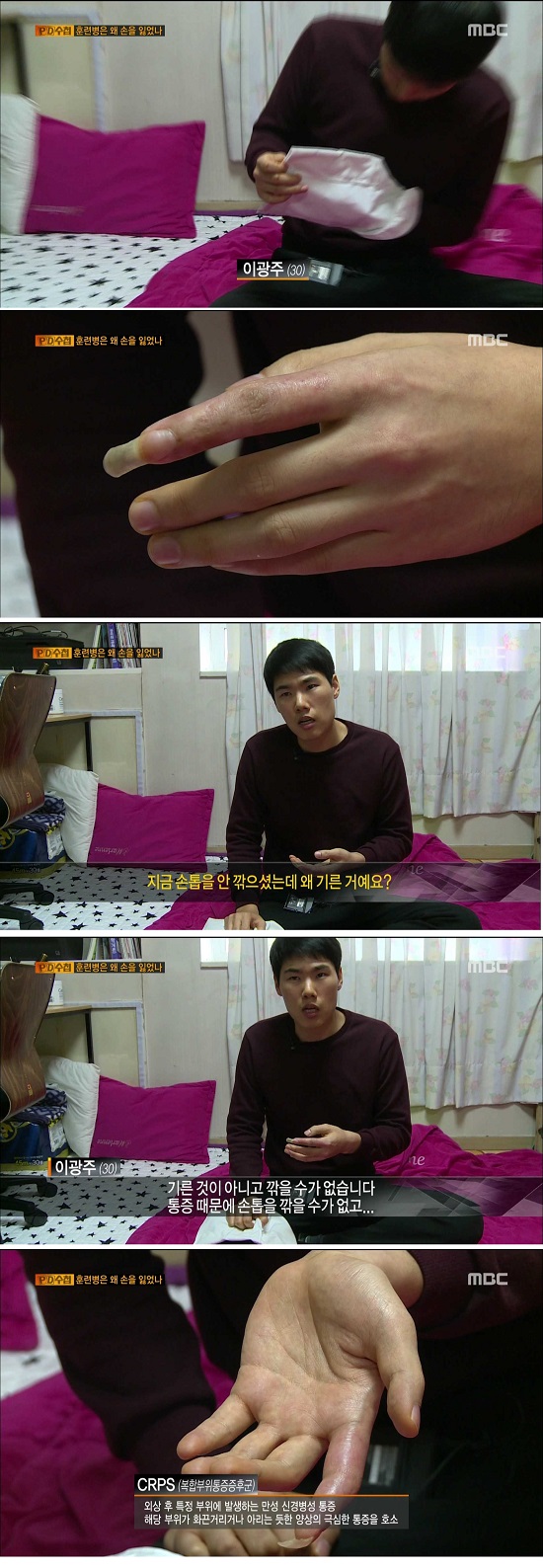 1124_235153_CH11-1_PD 수첩.jpg : 군대에서 유격훈련을 하다가 손을 다친 남자