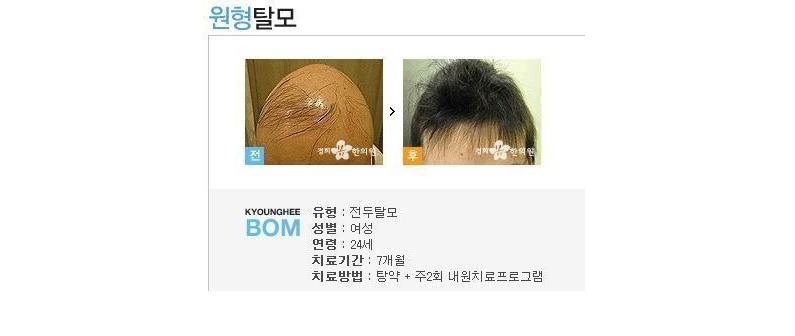 egg.jpg : 달걀가지고 사기치지마라.jpg