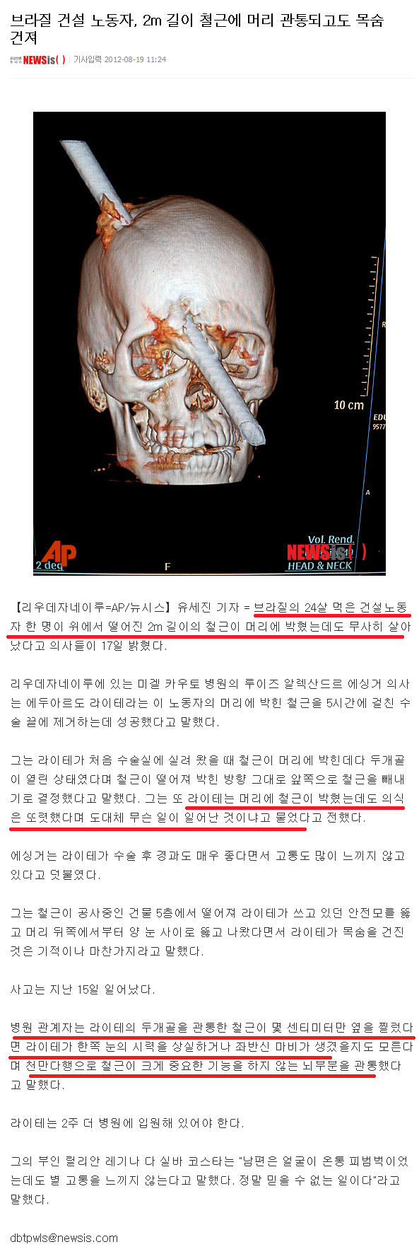 1.png : 2m 철근이 머리를 관통되고도 살아난 사람.jpg