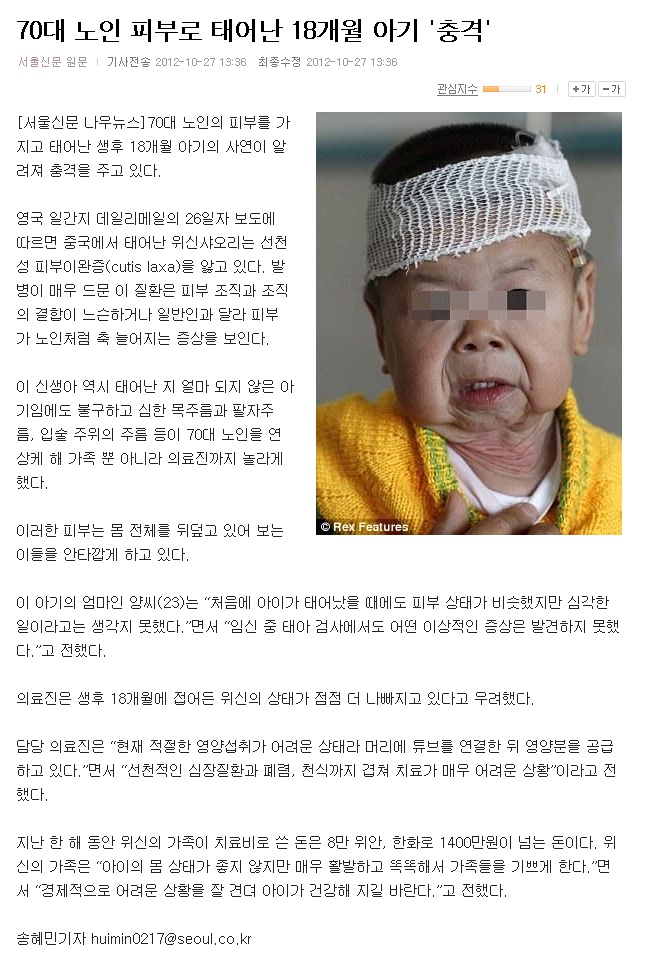 1 (1).jpg : 벤자민의 시간은 거꾸로간다 실사.jpg