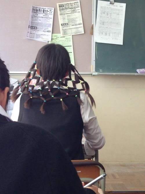 image.jpeg : 신경삭을 잘라야하네. 계승자!