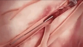 1e0c28edcb0803bd1bd2fbd1bbaec95c.gif