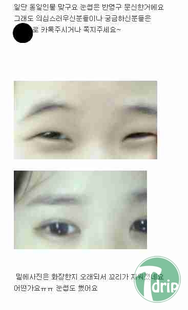 d0136392_4f8ffc5a8d652.png : 의느님도 시술후 놀랐을 짤.jpg