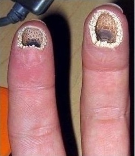 [수정]나의 공포증종류는? : 