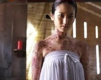 [수정]나의 공포증종류는? : 