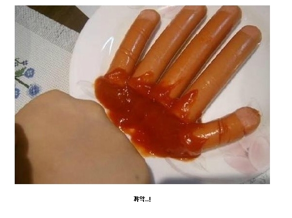 손가락이짤렸어요.jpg